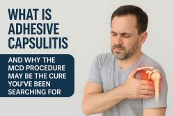 MCD Procedure